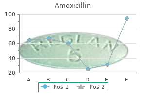 order amoxicillin 250mg with mastercard