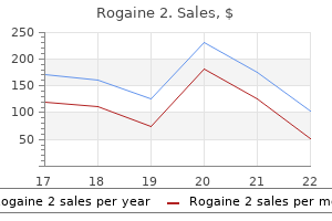 generic rogaine 2 60 ml